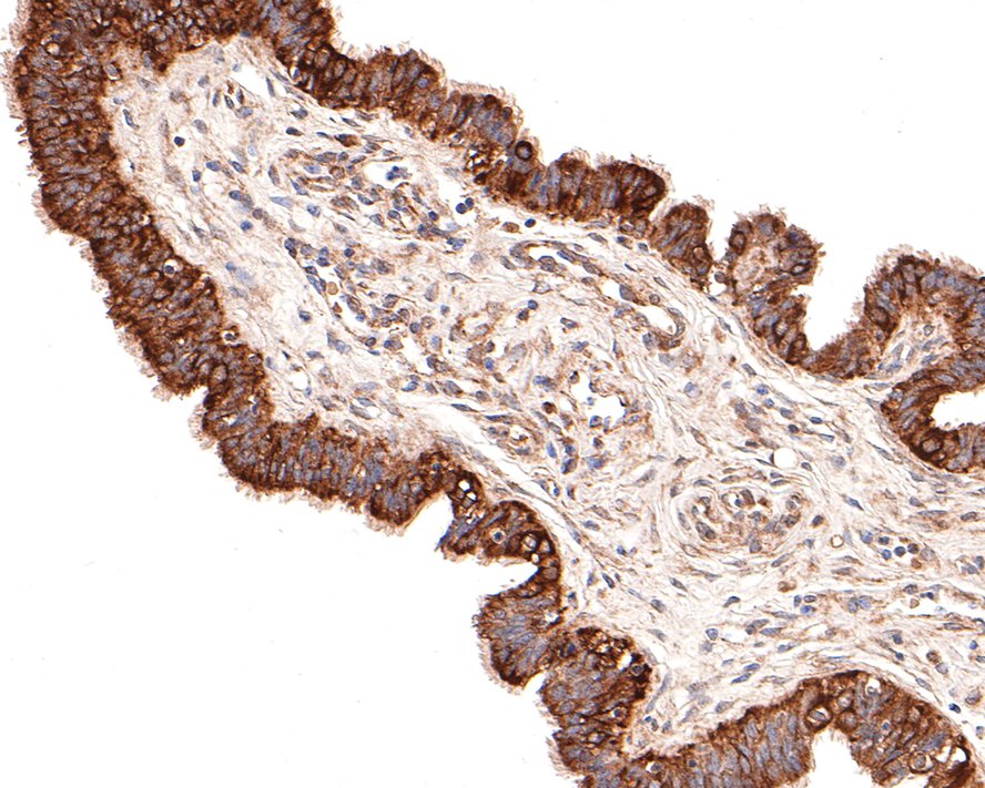 Immunohistochemical analysis of paraffin-embedded human fallopian tube tissue with Rabbit anti-beta Tubulin antibody (ET1602-4) at 1/100 dilution.<br />
<br />
The section was pre-treated using heat mediated antigen retrieval with Tris-EDTA buffer (pH 9.0) for 20 minutes. The tissues were blocked in 1% BSA for 20 minutes at room temperature, washed with ddH2O and PBS, and then probed with the primary antibody (ET1602-4) at 1/100 dilution for 1 hour at room temperature. The detection was performed using an HRP conjugated compact polymer system. DAB was used as the chromogen. Tissues were counterstained with hematoxylin and mounted with DPX.