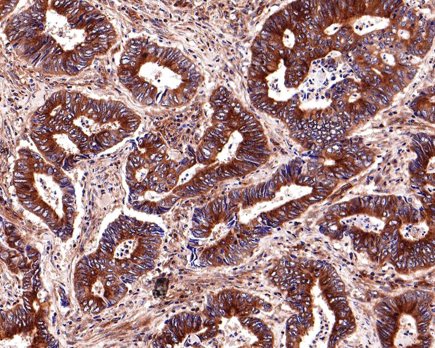 Immunohistochemical analysis of paraffin-embedded rat kidney tissue with Rabbit anti-beta Tubulin antibody (ET1602-4) at 1/400 dilution.<br />
<br />
The section was pre-treated using heat mediated antigen retrieval with Tris-EDTA buffer (pH 9.0) for 20 minutes. The tissues were blocked in 1% BSA for 20 minutes at room temperature, washed with ddH2O and PBS, and then probed with the primary antibody (ET1602-4) at 1/400 dilution for 1 hour at room temperature. The detection was performed using an HRP conjugated compact polymer system. DAB was used as the chromogen. Tissues were counterstained with hematoxylin and mounted with DPX.