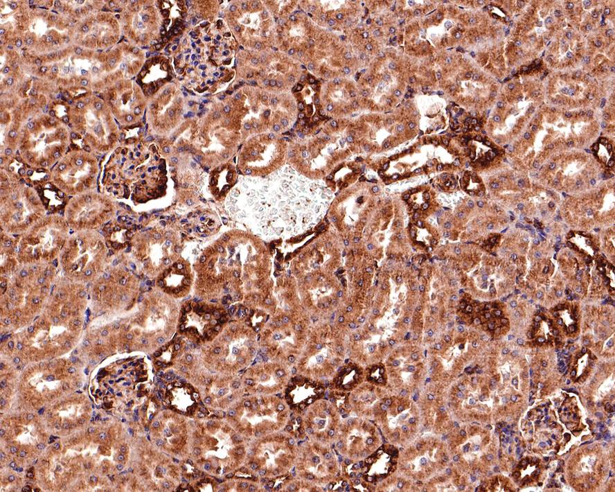 Immunohistochemical analysis of paraffin-embedded mouse large intestine tissue with Rabbit anti-beta Tubulin antibody (ET1602-4) at 1/400 dilution.<br />
<br />
The section was pre-treated using heat mediated antigen retrieval with Tris-EDTA buffer (pH 9.0) for 20 minutes. The tissues were blocked in 1% BSA for 20 minutes at room temperature, washed with ddH2O and PBS, and then probed with the primary antibody (ET1602-4) at 1/400 dilution for 1 hour at room temperature. The detection was performed using an HRP conjugated compact polymer system. DAB was used as the chromogen. Tissues were counterstained with hematoxylin and mounted with DPX.