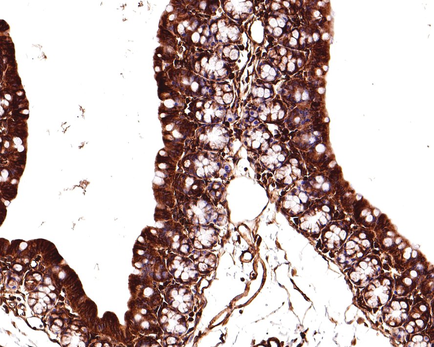 Immunohistochemical analysis of paraffin-embedded mouse large intestine tissue with Rabbit anti-beta Tubulin antibody (ET1602-4) at 1/400 dilution.<br />
<br />
The section was pre-treated using heat mediated antigen retrieval with Tris-EDTA buffer (pH 9.0) for 20 minutes. The tissues were blocked in 1% BSA for 20 minutes at room temperature, washed with ddH2O and PBS, and then probed with the primary antibody (ET1602-4) at 1/400 dilution for 1 hour at room temperature. The detection was performed using an HRP conjugated compact polymer system. DAB was used as the chromogen. Tissues were counterstained with hematoxylin and mounted with DPX.
