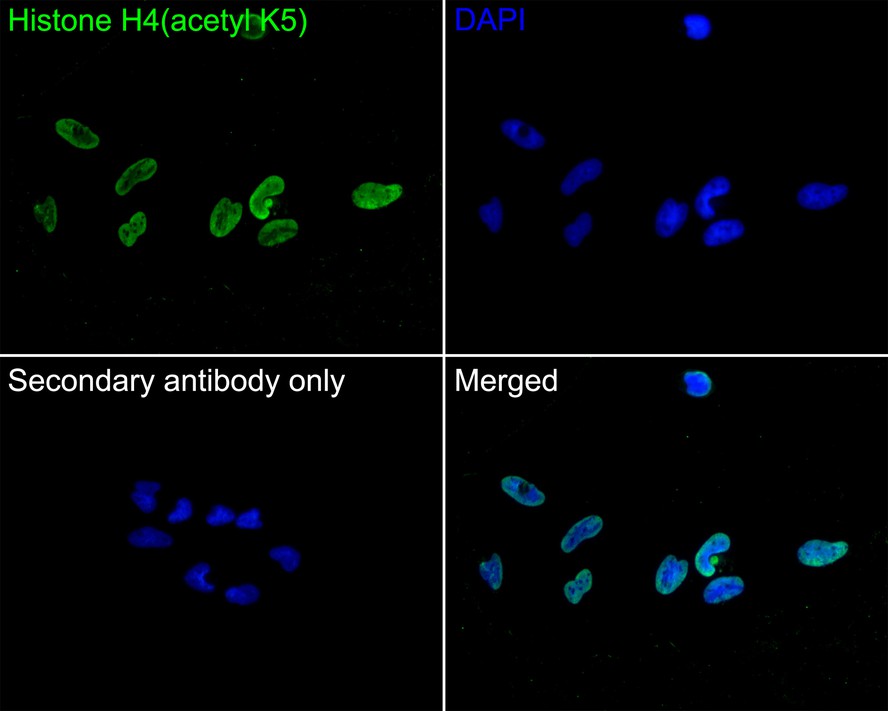 Immunocytochemistry analysis of Hela cells labeling Histone H4(acetyl K5) with Rabbit anti-Histone H4(acetyl K5) antibody (ET1602-40) at 1/50 dilution.<br />
<br />
Cells were fixed in 4% paraformaldehyde for 10 minutes at 37 ℃, permeabilized with 0.05% Triton X-100 in PBS for 20 minutes, and then blocked with 2% negative goat serum for 30 minutes at room temperature. Cells were then incubated with Rabbit anti-Histone H4(acetyl K5) antibody (ET1602-40) at 1/50 dilution in 2% negative goat serum overnight at 4 ℃. Goat Anti-Rabbit IgG H&L (iFluor™ 488, HA1121) was used as the secondary antibody at 1/1,000 dilution. PBS instead of the primary antibody was used as the secondary antibody only control. Nuclear DNA was labelled in blue with DAPI.