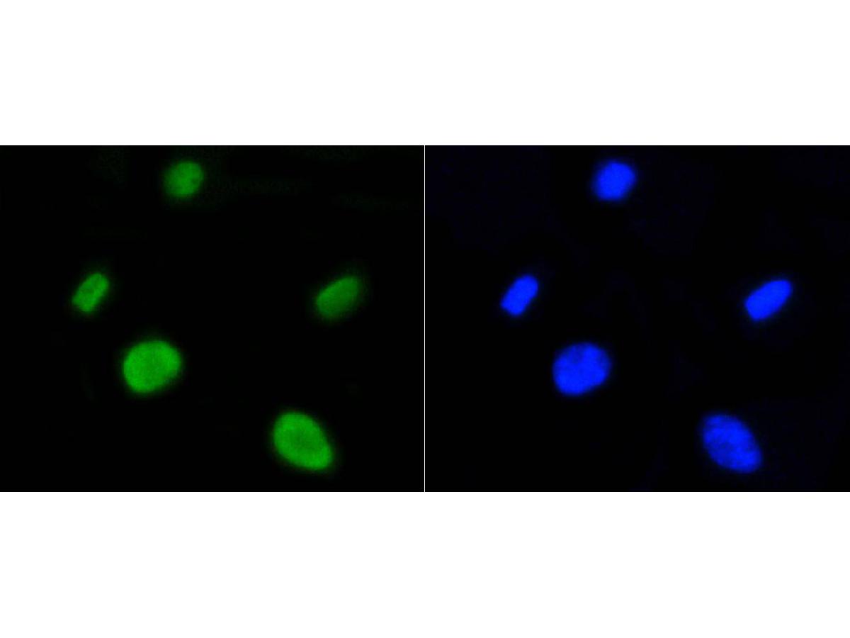 ICC staining of Histone H4(acetyl K5) in SH-SY5Y cells (green). Formalin fixed cells were permeabilized with 0.1% Triton X-100 in TBS for 10 minutes at room temperature and blocked with 1% Blocker BSA for 15 minutes at room temperature. Cells were probed with the primary antibody (ET1602-40, 1/50) for 1 hour at room temperature, washed with PBS. Alexa Fluor®488 Goat anti-Rabbit IgG was used as the secondary antibody at 1/1,000 dilution. The nuclear counter stain is DAPI (blue).