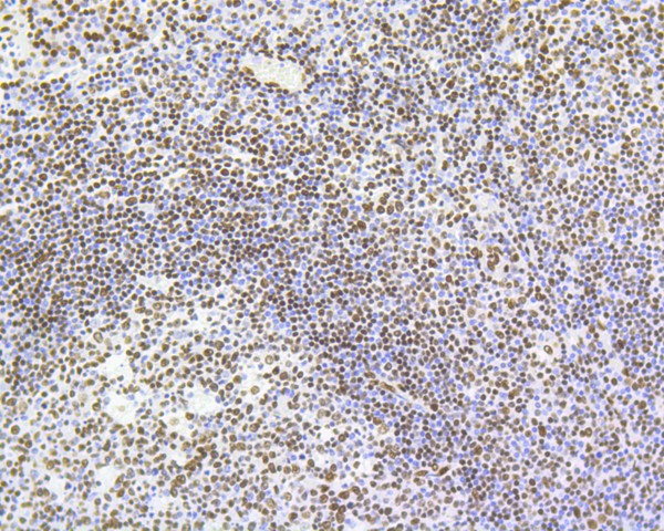 Immunohistochemical analysis of paraffin-embedded human tonsil tissue using anti-Histone H4(acetyl K5) antibody. The section was pre-treated using heat mediated antigen retrieval with Tris-EDTA buffer (pH 9.0) for 20 minutes.The tissues were blocked in 5% BSA for 30 minutes at room temperature, washed with ddH2O and PBS, and then probed with the primary antibody (ET1602-40, 1/1,000) for 30 minutes at room temperature. The detection was performed using an HRP conjugated compact polymer system. DAB was used as the chromogen. Tissues were counterstained with hematoxylin and mounted with DPX.