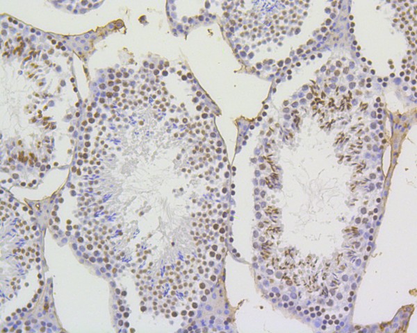 Immunohistochemical analysis of paraffin-embedded mouse testis tissue using anti-Histone H4(acetyl K5) antibody. The section was pre-treated using heat mediated antigen retrieval with Tris-EDTA buffer (pH 9.0) for 20 minutes.The tissues were blocked in 5% BSA for 30 minutes at room temperature, washed with ddH2O and PBS, and then probed with the primary antibody (ET1602-40, 1/1,000) for 30 minutes at room temperature. The detection was performed using an HRP conjugated compact polymer system. DAB was used as the chromogen. Tissues were counterstained with hematoxylin and mounted with DPX.