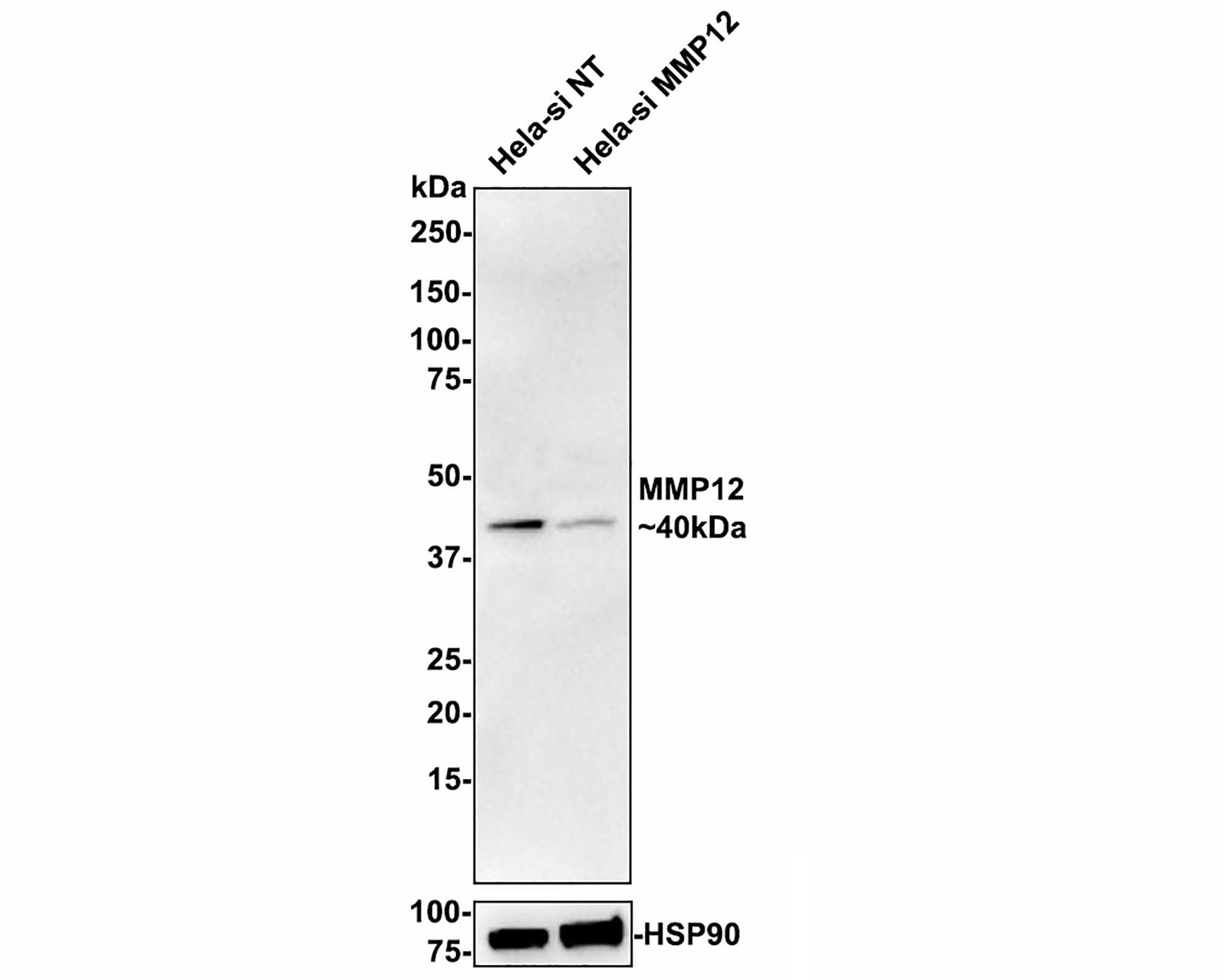 Western blot analysis of MMP12 on different lysates with Rabbit anti-MMP12 antibody (ET1602-42) at 1/500 dilution.<br />
<br />
Lane 1: Mouse lung tissue lysate<br />
Lane 2: Rat lung tissue lysate<br />
<br />
Lysates/proteins at 20 µg/Lane.<br />
<br />
Predicted band size: 54 kDa<br />
Observed band size: 40 kDa<br />
<br />
Exposure time: 1 minute;<br />
<br />
8% SDS-PAGE gel.<br />
<br />
Proteins were transferred to a PVDF membrane and blocked with 5% NFDM/TBST for 1 hour at room temperature. The primary antibody (ET1602-42) at 1/500 dilution was used in 5% NFDM/TBST at room temperature for 2 hours. Goat Anti-Rabbit IgG - HRP Secondary Antibody (HA1001) at 1:200,000 dilution was used for 1 hour at room temperature.