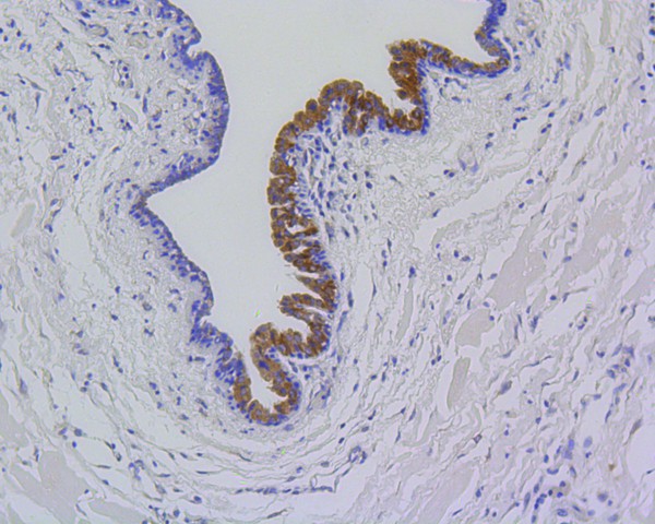 Immunohistochemical analysis of paraffin-embedded mouse lung tissue using anti-MMP12 antibody. The section was pre-treated using heat mediated antigen retrieval with Tris-EDTA buffer (pH 8.0-8.4) for 20 minutes.The tissues were blocked in 5% BSA for 30 minutes at room temperature, washed with ddH2O and PBS, and then probed with the primary antibody (ET1602-42, 1/50) for 30 minutes at room temperature. The detection was performed using an HRP conjugated compact polymer system. DAB was used as the chromogen. Tissues were counterstained with hematoxylin and mounted with DPX.
