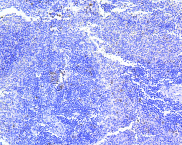 Immunohistochemical analysis of paraffin-embedded rat spleen tissue using anti-Survivin antibody. The section was pre-treated using heat mediated antigen retrieval with Tris-EDTA buffer (pH 8.0-8.4) for 20 minutes.The tissues were blocked in 5% BSA for 30 minutes at room temperature, washed with ddH2O and PBS, and then probed with the primary antibody (ET1602-43, 1/50) for 30 minutes at room temperature. The detection was performed using an HRP conjugated compact polymer system. DAB was used as the chromogen. Tissues were counterstained with hematoxylin and mounted with DPX.