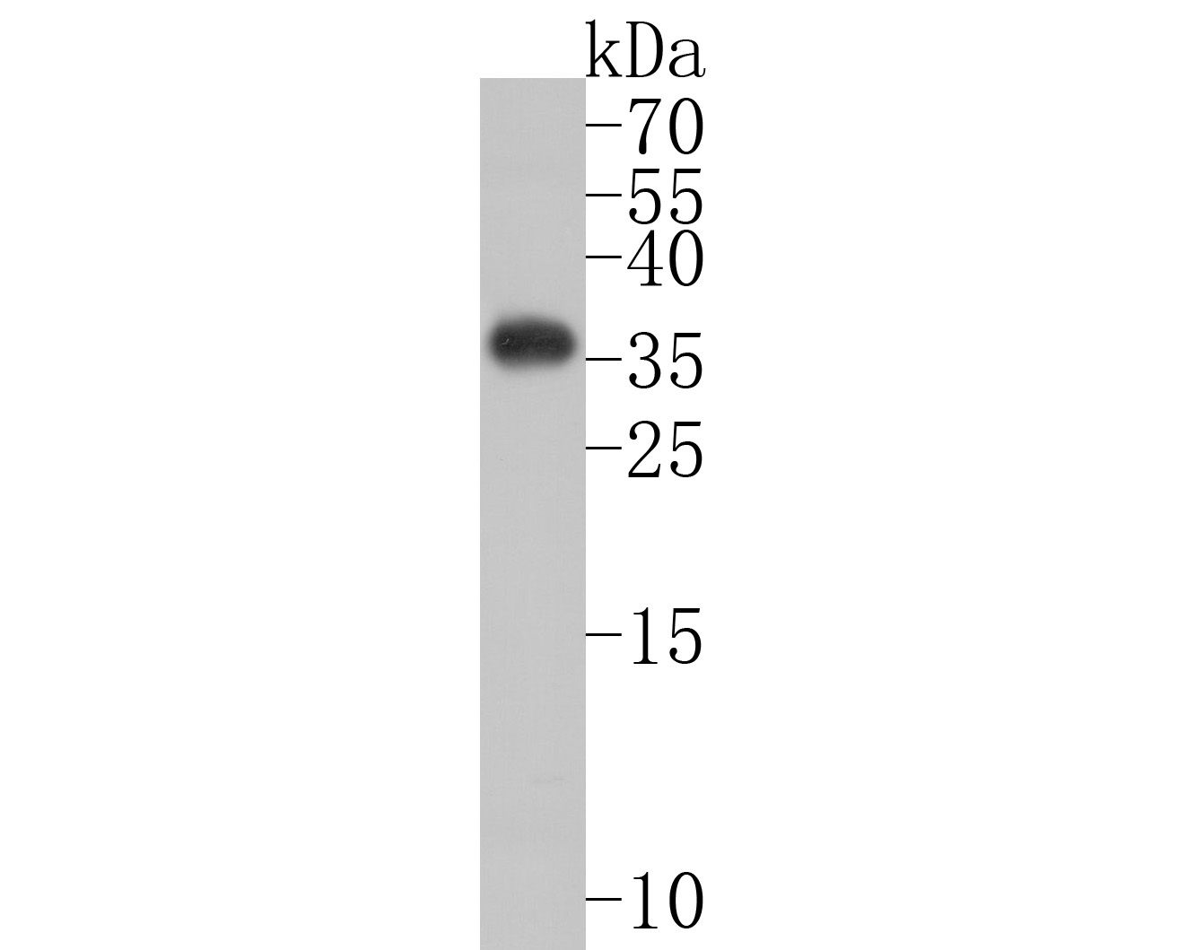 Western blot analysis of Renilla Luciferase on luciferase recombinant protein. Proteins were transferred to a PVDF membrane and blocked with 5% BSA in PBS for 1 hour at room temperature. The primary antibody (ET1602-45, 1/500) was used in 5% BSA at room temperature for 2 hours. Goat Anti-Rabbit IgG - HRP Secondary Antibody (HA1001) at 1:200,000 dilution was used for 1 hour at room temperature.
