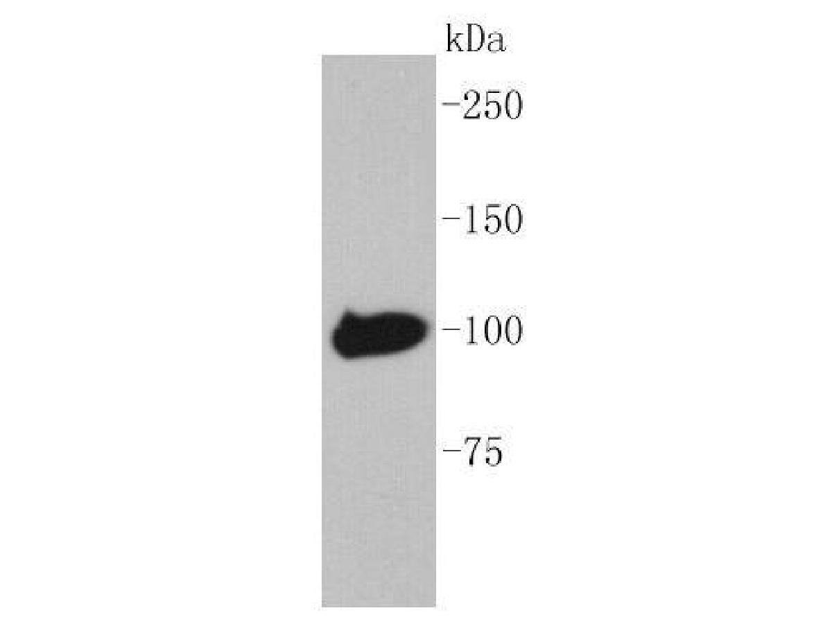 1/1.000 seyreltmede anti-Maltoz Bağlayıcı Protein antikoru kullanılarak rekombinant MBP-etiket protein lizatları üzerinde Maltoz Bağlayıcı Proteinin Western blot analizi.