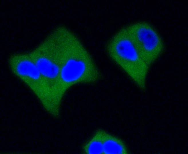 ICC staining of Active Caspase-3 in Hela cells (green). Formalin fixed cells were permeabilized with 0.1% Triton X-100 in TBS for 10 minutes at room temperature and blocked with 1% Blocker BSA for 15 minutes at room temperature. Cells were probed with the primary antibody (ET1602-47, 1/50) for 1 hour at room temperature, washed with PBS. Alexa Fluor®488 Goat anti-Rabbit IgG was used as the secondary antibody at 1/1,000 dilution. The nuclear counter stain is DAPI (blue).