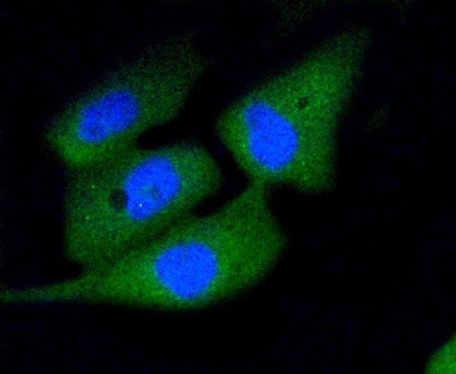 ICC staining of Active Caspase-3 in PC-3M cells (green). Formalin fixed cells were permeabilized with 0.1% Triton X-100 in TBS for 10 minutes at room temperature and blocked with 1% Blocker BSA for 15 minutes at room temperature. Cells were probed with the primary antibody (ET1602-47, 1/50) for 1 hour at room temperature, washed with PBS. Alexa Fluor®488 Goat anti-Rabbit IgG was used as the secondary antibody at 1/1,000 dilution. The nuclear counter stain is DAPI (blue).