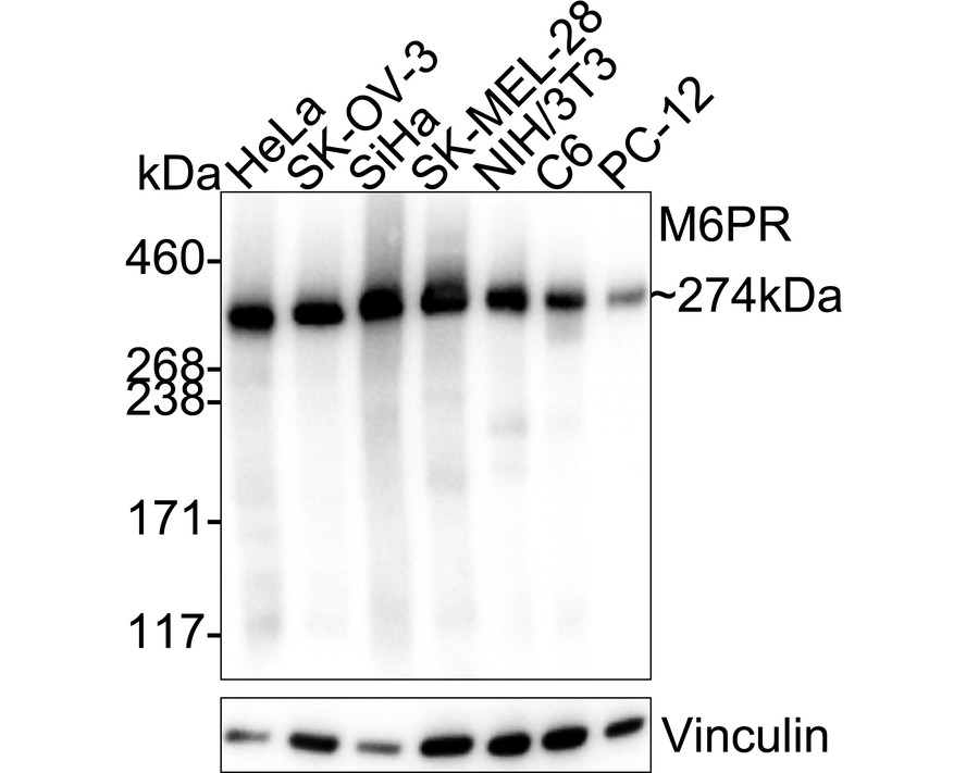 M6PR'nin farklı lizatlar üzerinde Western blot analizi.  Proteinler bir PVDF membranına aktarıldı ve oda sıcaklığında 1 saat boyunca PBS içinde %5 BSA ile bloke edildi.  Primer antikor (ET1602-5, 1/500), 2 saat boyunca oda sıcaklığında %5 BSA içinde kullanıldı.  Keçi Anti-Rabbit IgG - HRP Sekonder Antikoru (HA1001) 1:5,000 seyreltmede oda sıcaklığında 1 saat kullanıldı.  Pozitif kontrol: Şerit 1: SiHa hücre lizatı Şerit 2: insan derisi doku lizatı