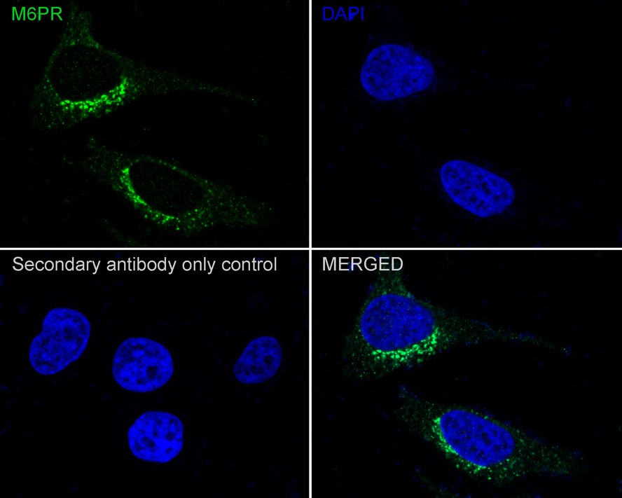 ICC staining of M6PR in Hela cells (green). Formalin fixed cells were permeabilized with 0.1% Triton X-100 in TBS for 10 minutes at room temperature and blocked with 1% Blocker BSA for 15 minutes at room temperature. Cells were probed with the primary antibody (ET1602-5, 1/50) for 1 hour at room temperature, washed with PBS. Alexa Fluor®488 Goat anti-Rabbit IgG was used as the secondary antibody at 1/1,000 dilution. The nuclear counter stain is DAPI (blue).