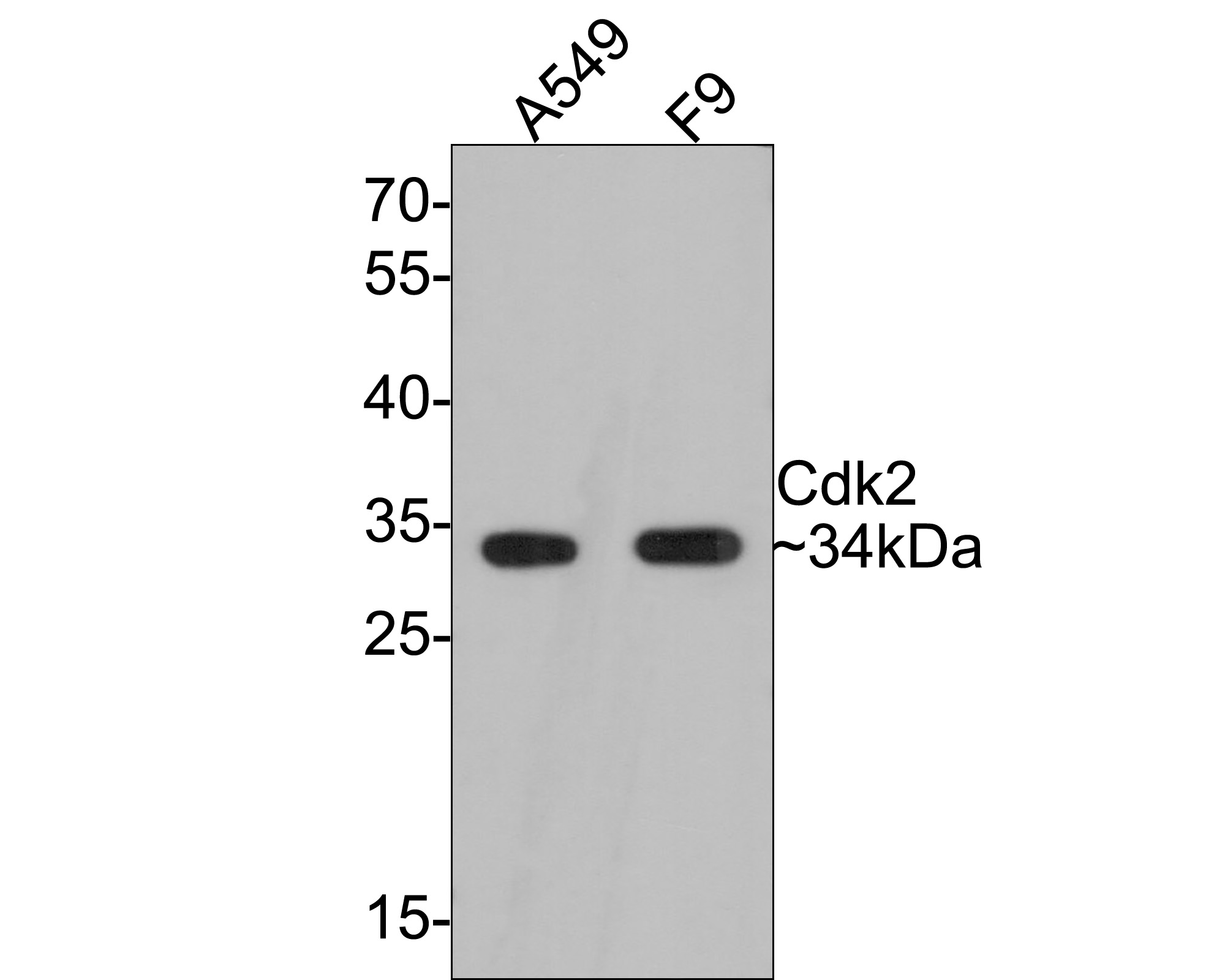 Farklı lizatlar üzerinde Cdk2'nin Western blot analizi.  Proteinler bir PVDF membranına aktarıldı ve oda sıcaklığında 1 saat boyunca PBS içinde %5 BSA ile bloke edildi.  Birincil antikor (ET1602-6, 1/500), 2 saat boyunca oda sıcaklığında %5 BSA içinde kullanıldı.  Keçi Anti-Rabbit IgG - HRP Sekonder Antikoru (HA1001) 1:5,000 seyreltmede oda sıcaklığında 1 saat kullanıldı.  Pozitif kontrol: Şerit 1: A549 hücre lizatı Şerit 2: F9 hücre lizatı