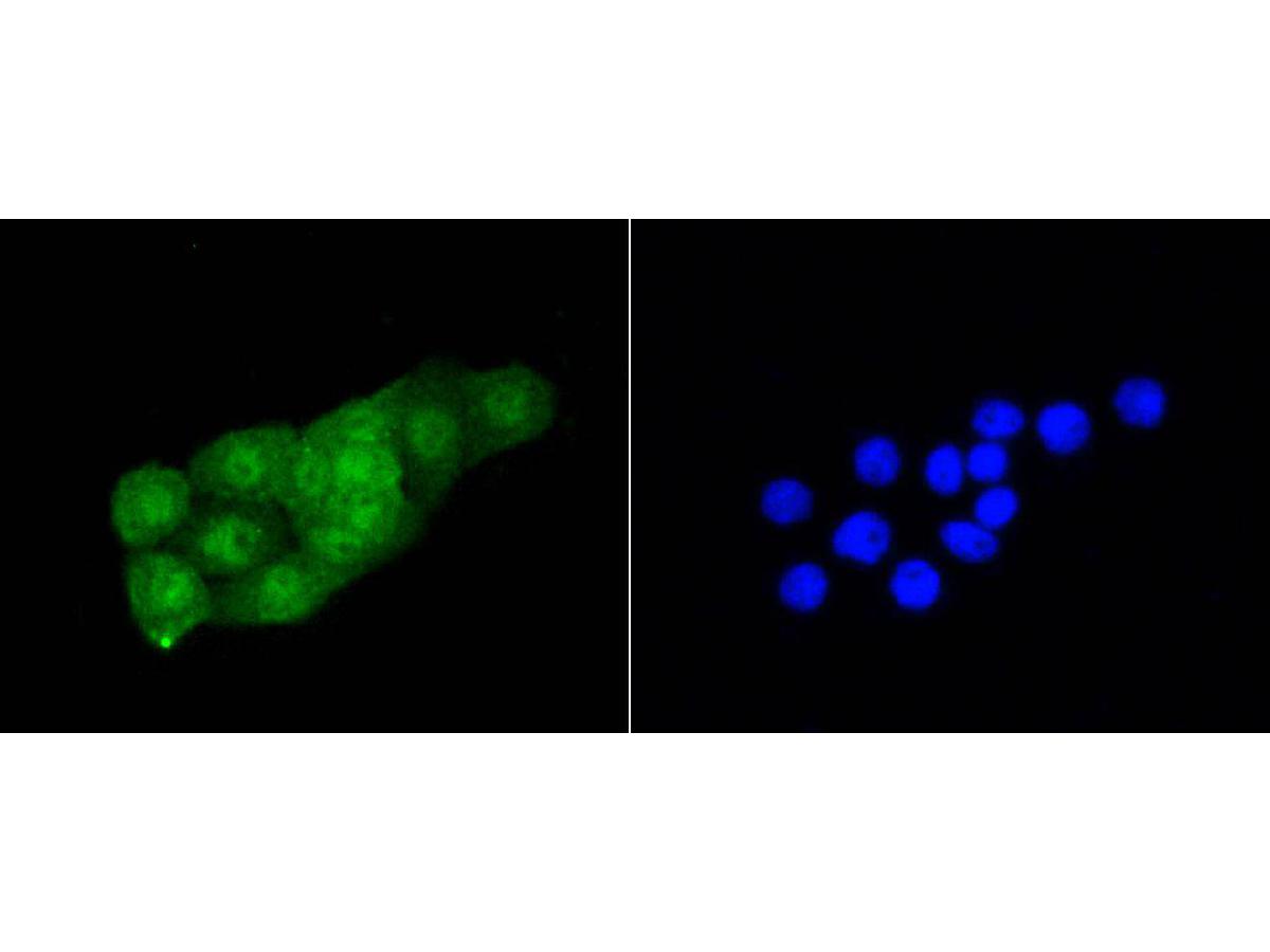ICC staining of Cdk2 in SH-SY5Y cells (green). Formalin fixed cells were permeabilized with 0.1% Triton X-100 in TBS for 10 minutes at room temperature and blocked with 1% Blocker BSA for 15 minutes at room temperature. Cells were probed with the primary antibody (ET1602-6, 1/50) for 1 hour at room temperature, washed with PBS. Alexa Fluor®488 Goat anti-Rabbit IgG was used as the secondary antibody at 1/1,000 dilution. The nuclear counter stain is DAPI (blue).