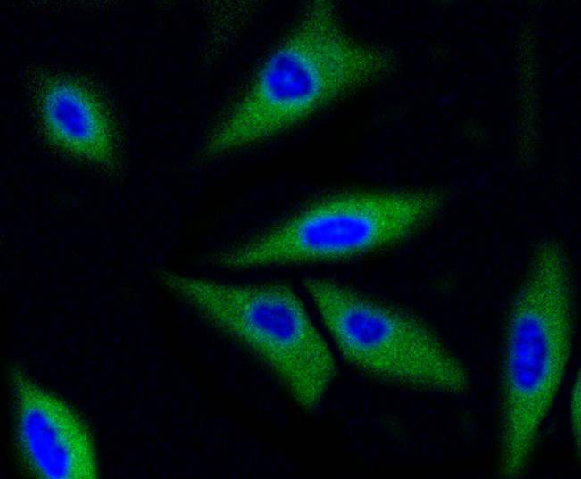ICC staining of Cdk2 in N2A cells (green). Formalin fixed cells were permeabilized with 0.1% Triton X-100 in TBS for 10 minutes at room temperature and blocked with 1% Blocker BSA for 15 minutes at room temperature. Cells were probed with the primary antibody (ET1602-6, 1/50) for 1 hour at room temperature, washed with PBS. Alexa Fluor®488 Goat anti-Rabbit IgG was used as the secondary antibody at 1/1,000 dilution. The nuclear counter stain is DAPI (blue).