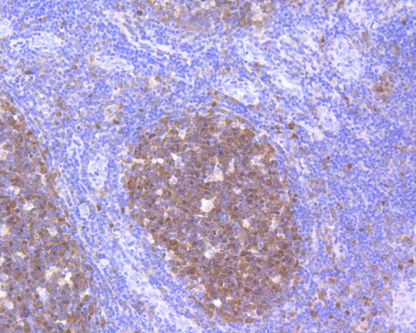 Immunohistochemical analysis of paraffin-embedded human spleen tissue using anti-Cdk2 antibody. The section was pre-treated using heat mediated antigen retrieval with Tris-EDTA buffer (pH 8.0-8.4) for 20 minutes.The tissues were blocked in 5% BSA for 30 minutes at room temperature, washed with ddH2O and PBS, and then probed with the primary antibody (ET1602-6, 1/50) for 30 minutes at room temperature. The detection was performed using an HRP conjugated compact polymer system. DAB was used as the chromogen. Tissues were counterstained with hematoxylin and mounted with DPX.