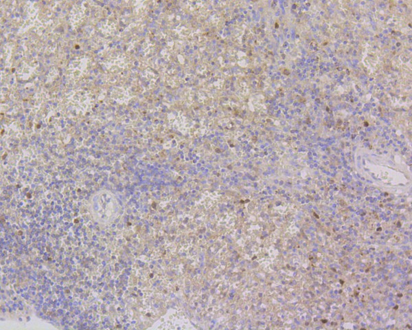 Immunohistochemical analysis of paraffin-embedded mouse spleen tissue using anti-Cdk2 antibody. The section was pre-treated using heat mediated antigen retrieval with Tris-EDTA buffer (pH 8.0-8.4) for 20 minutes.The tissues were blocked in 5% BSA for 30 minutes at room temperature, washed with ddH2O and PBS, and then probed with the primary antibody (ET1602-6, 1/50) for 30 minutes at room temperature. The detection was performed using an HRP conjugated compact polymer system. DAB was used as the chromogen. Tissues were counterstained with hematoxylin and mounted with DPX.