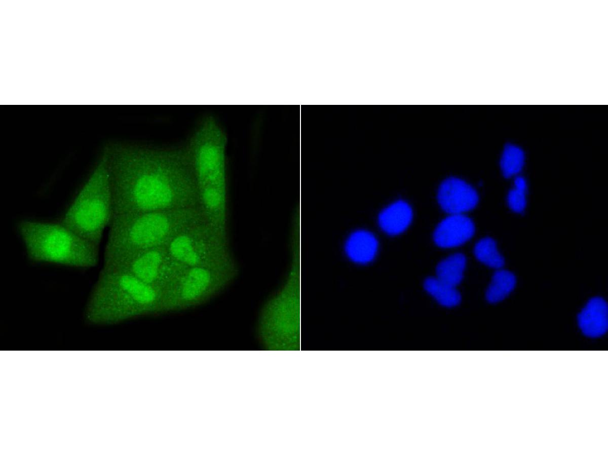 ICC staining of HP1 alpha in Hela cells (green). Formalin fixed cells were permeabilized with 0.1% Triton X-100 in TBS for 10 minutes at room temperature and blocked with 10% negative goat serum for 15 minutes at room temperature. Cells were probed with the primary antibody (ET1602-8, 1/50) for 1 hour at room temperature, washed with PBS. Alexa Fluor®488 conjugate-Goat anti-Rabbit IgG was used as the secondary antibody at 1/1,000 dilution. The nuclear counter stain is DAPI (blue).