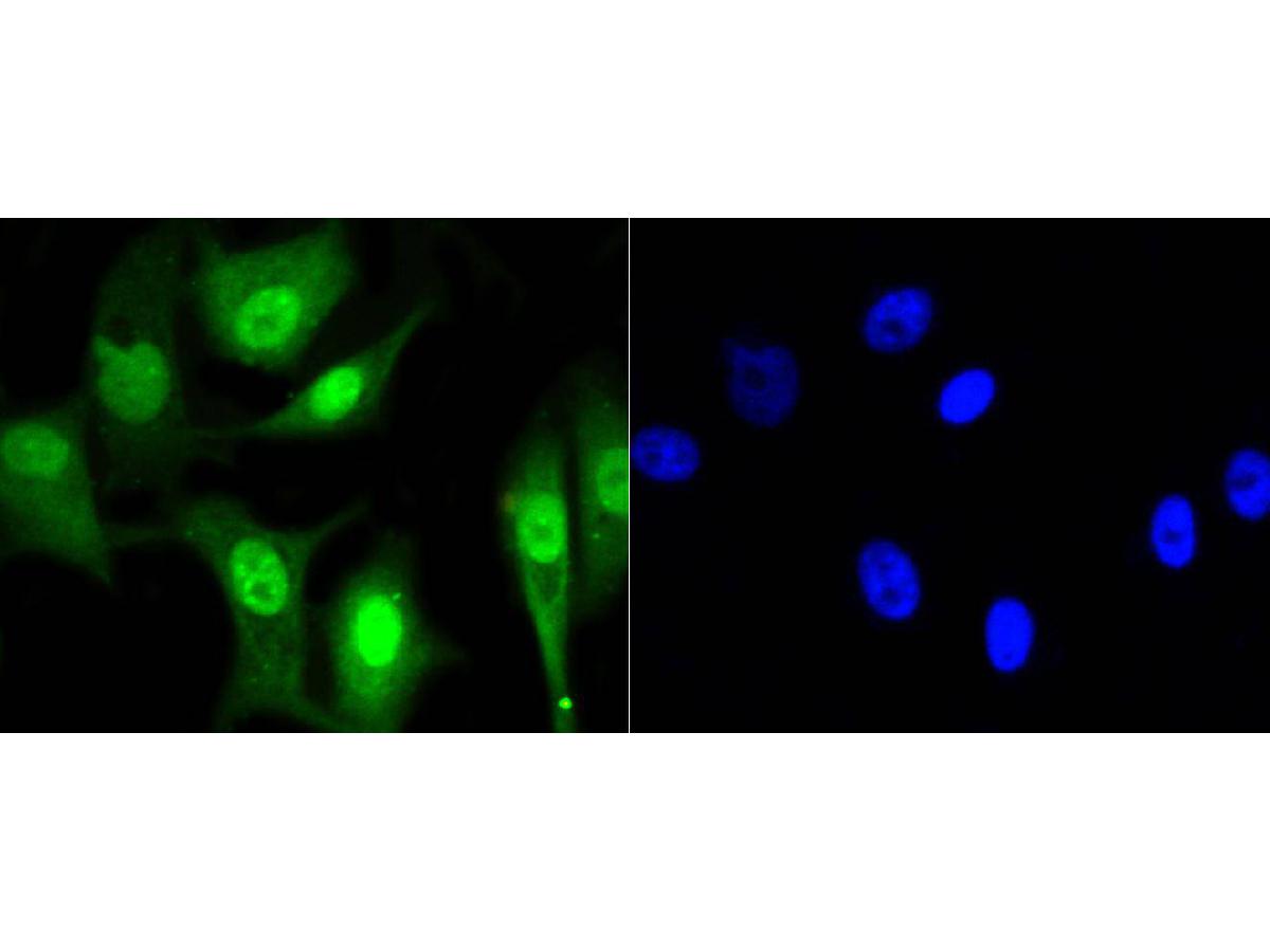 ICC staining of HP1 alpha in MCF-7 cells (green). Formalin fixed cells were permeabilized with 0.1% Triton X-100 in TBS for 10 minutes at room temperature and blocked with 10% negative goat serum for 15 minutes at room temperature. Cells were probed with the primary antibody (ET1602-8, 1/50) for 1 hour at room temperature, washed with PBS. Alexa Fluor®488 conjugate-Goat anti-Rabbit IgG was used as the secondary antibody at 1/1,000 dilution. The nuclear counter stain is DAPI (blue).