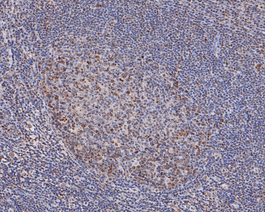 Immunohistochemical analysis of paraffin-embedded human tonsil tissue with Rabbit anti-HP1 alpha antibody (ET1602-8) at 1/50 dilution.<br />
<br />
The section was pre-treated using heat mediated antigen retrieval with sodium citrate buffer (pH 6.0) for 2 minutes. The tissues were blocked in 1% BSA for 20 minutes at room temperature, washed with ddH2O and PBS, and then probed with the primary antibody (ET1602-8) at 1/50 dilution for 1 hour at room temperature. The detection was performed using an HRP conjugated compact polymer system. DAB was used as the chromogen. Tissues were counterstained with hematoxylin and mounted with DPX.