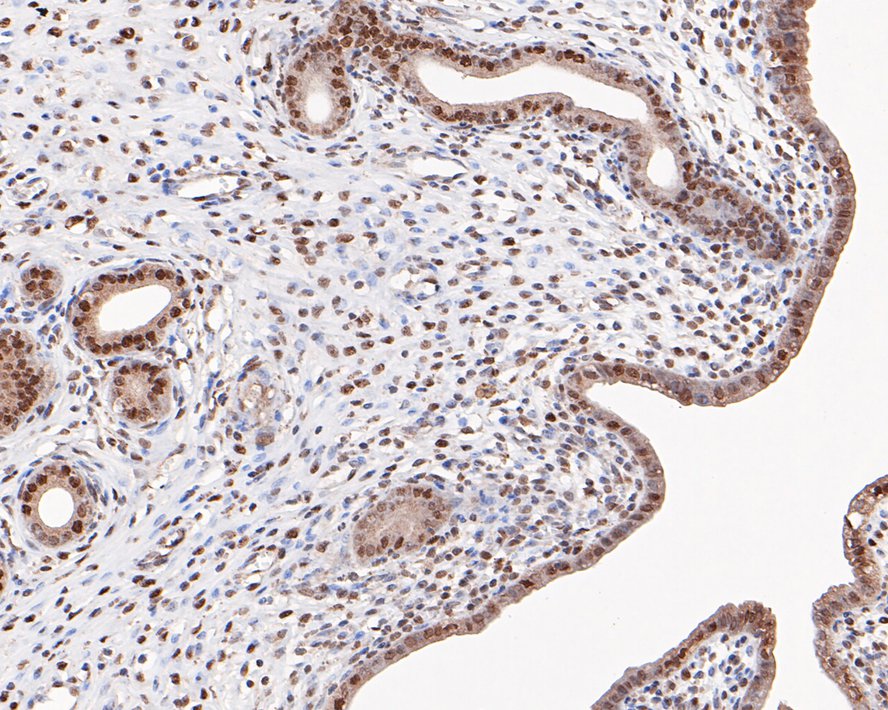 Immunohistochemical analysis of paraffin-embedded rat uterus tissue with Rabbit anti-HP1 alpha antibody (ET1602-8) at 1/200 dilution.<br />
<br />
The section was pre-treated using heat mediated antigen retrieval with sodium citrate buffer (pH 6.0) for 2 minutes. The tissues were blocked in 1% BSA for 20 minutes at room temperature, washed with ddH2O and PBS, and then probed with the primary antibody (ET1602-8) at 1/200 dilution for 1 hour at room temperature. The detection was performed using an HRP conjugated compact polymer system. DAB was used as the chromogen. Tissues were counterstained with hematoxylin and mounted with DPX.