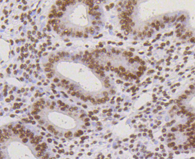 Immunohistochemical analysis of paraffin-embedded human uterus tissue using anti-HP1 alpha antibody. The section was pre-treated using heat mediated antigen retrieval with Tris-EDTA buffer (pH 9.0) for 20 minutes.The tissues were blocked in 1% BSA for 30 minutes at room temperature, washed with ddH2O and PBS, and then probed with the primary antibody (ET1602-8, 1/50) for 30 minutes at room temperature. The detection was performed using an HRP conjugated compact polymer system. DAB was used as the chromogen. Tissues were counterstained with hematoxylin and mounted with DPX.