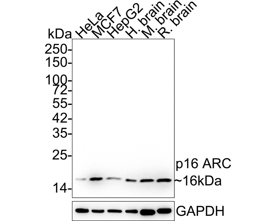 1/1.000 seyreltmede anti-p16 ARC antikoru kullanılarak farklı hücre lizatları üzerinde p16 ARC'nin Western blot analizi.  Pozitif kontrol: Şerit 1: MCF-7 Şerit 2: SK-BR-3