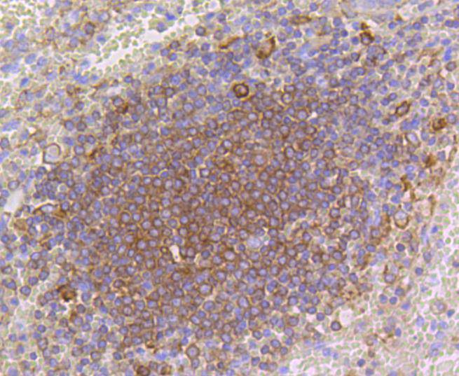 Immunohistochemical analysis of paraffin-embedded mouse lung tissue using anti-p16 ARC antibody. The section was pre-treated using heat mediated antigen retrieval with Tris-EDTA buffer (pH 9.0) for 20 minutes.The tissues were blocked in 1% BSA for 30 minutes at room temperature, washed with ddH2O and PBS, and then probed with the primary antibody (ET1602-9, 1/50) for 30 minutes at room temperature. The detection was performed using an HRP conjugated compact polymer system. DAB was used as the chromogen. Tissues were counterstained with hematoxylin and mounted with DPX.