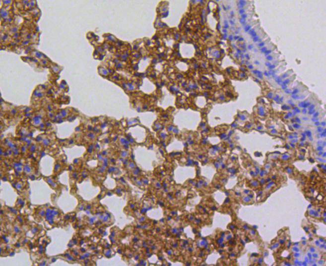 Immunohistochemical analysis of paraffin-embedded mouse spleen tissue using anti-p16 ARC antibody. The section was pre-treated using heat mediated antigen retrieval with Tris-EDTA buffer (pH 9.0) for 20 minutes.The tissues were blocked in 1% BSA for 30 minutes at room temperature, washed with ddH2O and PBS, and then probed with the primary antibody (ET1602-9, 1/50) for 30 minutes at room temperature. The detection was performed using an HRP conjugated compact polymer system. DAB was used as the chromogen. Tissues were counterstained with hematoxylin and mounted with DPX.