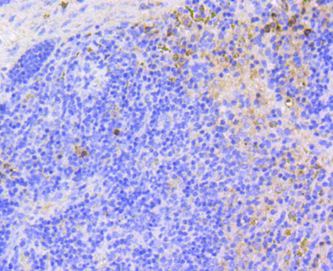Immunohistochemical analysis of paraffin-embedded human placenta tissue using anti-p16 ARC antibody. The section was pre-treated using heat mediated antigen retrieval with Tris-EDTA buffer (pH 9.0) for 20 minutes.The tissues were blocked in 1% BSA for 30 minutes at room temperature, washed with ddH2O and PBS, and then probed with the primary antibody (ET1602-9, 1/50) for 30 minutes at room temperature. The detection was performed using an HRP conjugated compact polymer system. DAB was used as the chromogen. Tissues were counterstained with hematoxylin and mounted with DPX.