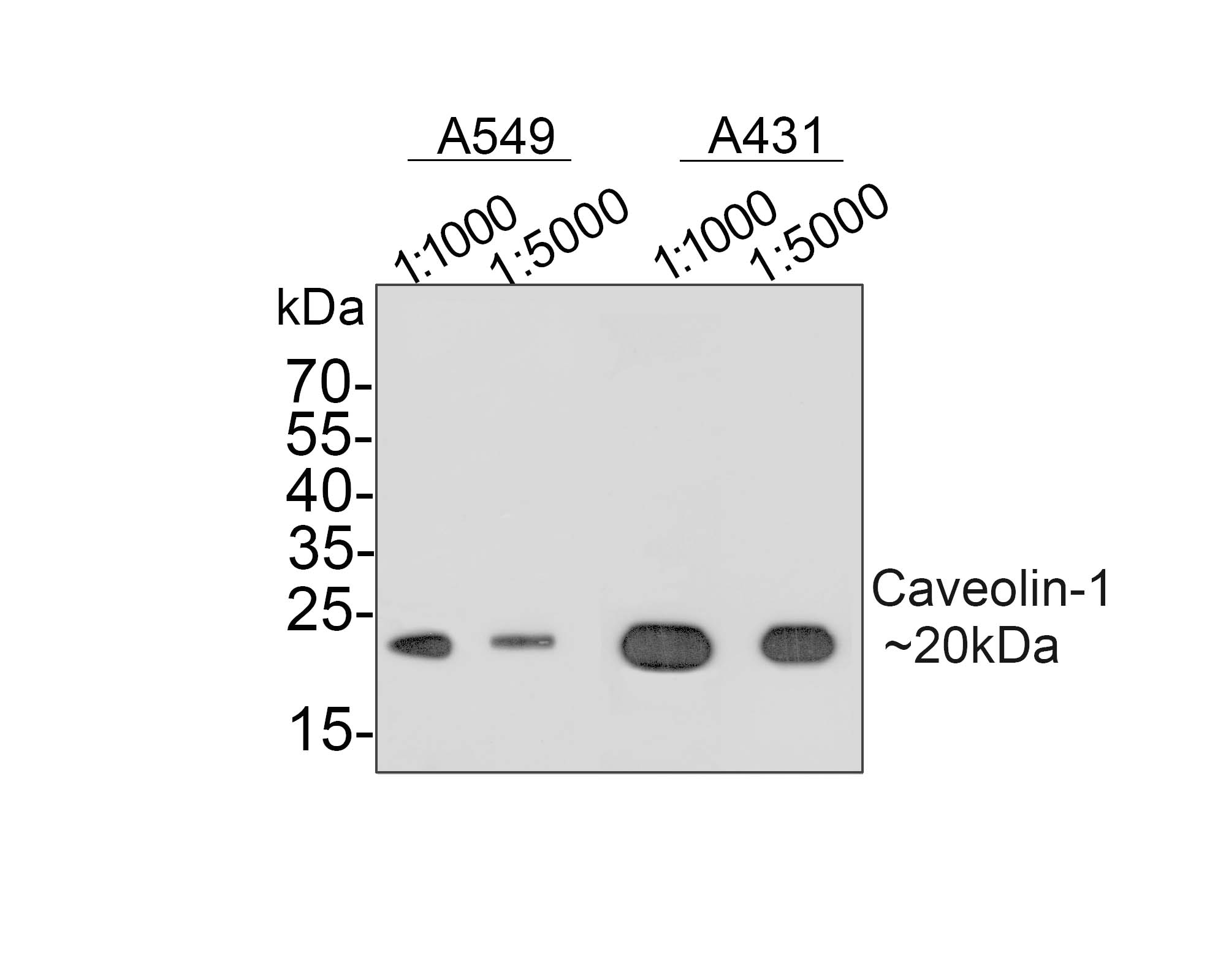 Caveolin-1'in farklı lizatlar üzerinde Western blot analizi.  Proteinler bir PVDF membranına aktarıldı ve oda sıcaklığında 1 saat boyunca PBS içinde %5 BSA ile bloke edildi.  Primer antikor (ET1603-1, 1/500), 2 saat boyunca oda sıcaklığında %5 BSA içinde kullanıldı.  Keçi Anti-Rabbit IgG - HRP Sekonder Antikoru (HA1001) 1:5,000 seyreltmede oda sıcaklığında 1 saat kullanıldı.  Pozitif kontrol: Şerit 1: A549 hücre lizatı Şerit 2: A431 hücre lizatı