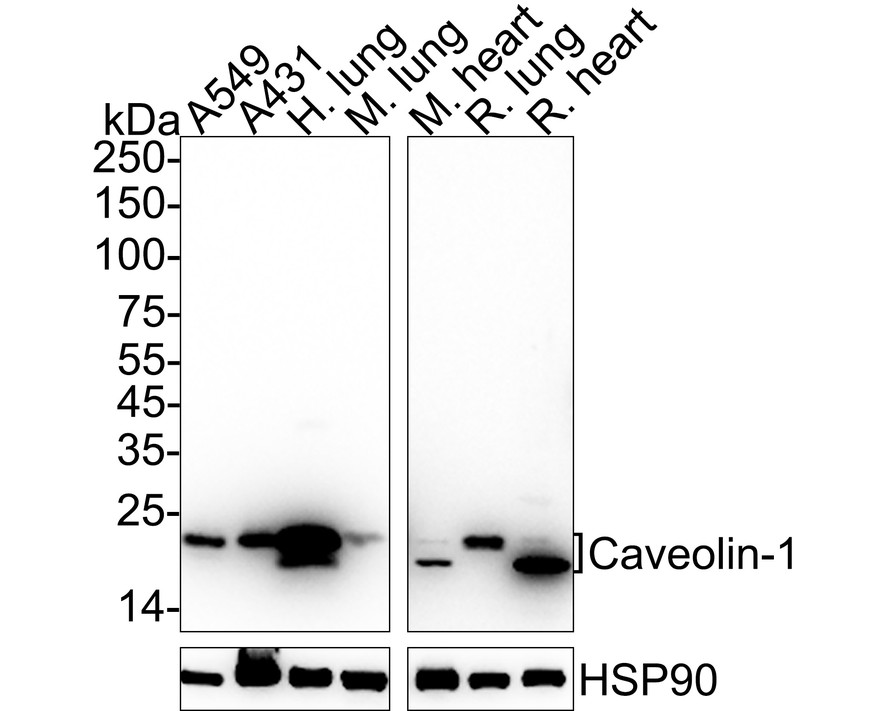 ICC staining of Caveolin-1 in A549 cells (green). Formalin fixed cells were permeabilized with 0.1% Triton X-100 in TBS for 10 minutes at room temperature and blocked with 1% Blocker BSA for 15 minutes at room temperature. Cells were probed with the primary antibody (ET1603-1, 1/50) for 1 hour at room temperature, washed with PBS. Alexa Fluor®488 Goat anti-Rabbit IgG was used as the secondary antibody at 1/1,000 dilution. The nuclear counter stain is DAPI (blue).