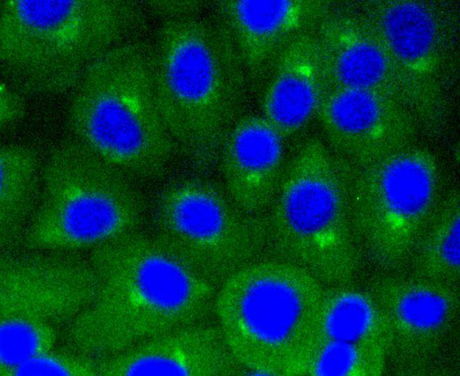 ICC staining of Caveolin-1 in MCF-7 cells (green). Formalin fixed cells were permeabilized with 0.1% Triton X-100 in TBS for 10 minutes at room temperature and blocked with 1% Blocker BSA for 15 minutes at room temperature. Cells were probed with the primary antibody (ET1603-1, 1/50) for 1 hour at room temperature, washed with PBS. Alexa Fluor®488 Goat anti-Rabbit IgG was used as the secondary antibody at 1/1,000 dilution. The nuclear counter stain is DAPI (blue).