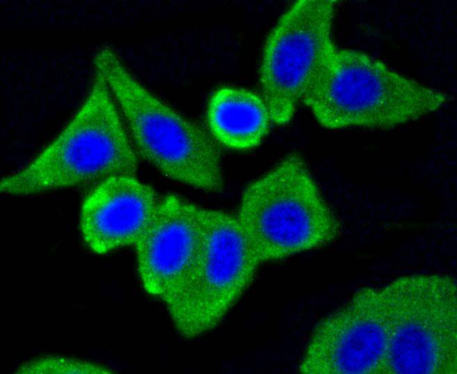 ICC staining of Caveolin-1 in NIH/3T3 cells (green). Formalin fixed cells were permeabilized with 0.1% Triton X-100 in TBS for 10 minutes at room temperature and blocked with 1% Blocker BSA for 15 minutes at room temperature. Cells were probed with the primary antibody (ET1603-1, 1/50) for 1 hour at room temperature, washed with PBS. Alexa Fluor®488 Goat anti-Rabbit IgG was used as the secondary antibody at 1/1,000 dilution. The nuclear counter stain is DAPI (blue).