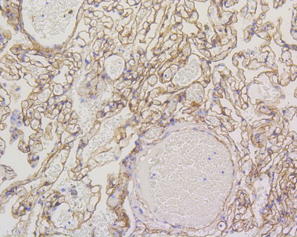 Immunohistochemical analysis of paraffin-embedded human liver tissue with Rabbit anti-Caveolin-1 antibody (ET1603-1) at 1/200 dilution.<br />
<br />
The section was pre-treated using heat mediated antigen retrieval with Tris-EDTA buffer (pH 9.0) for 20 minutes. The tissues were blocked in 1% BSA for 20 minutes at room temperature, washed with ddH2O and PBS, and then probed with the primary antibody (ET1603-1) at 1/200 dilution for 1 hour at room temperature. The detection was performed using an HRP conjugated compact polymer system. DAB was used as the chromogen. Tissues were counterstained with hematoxylin and mounted with DPX.