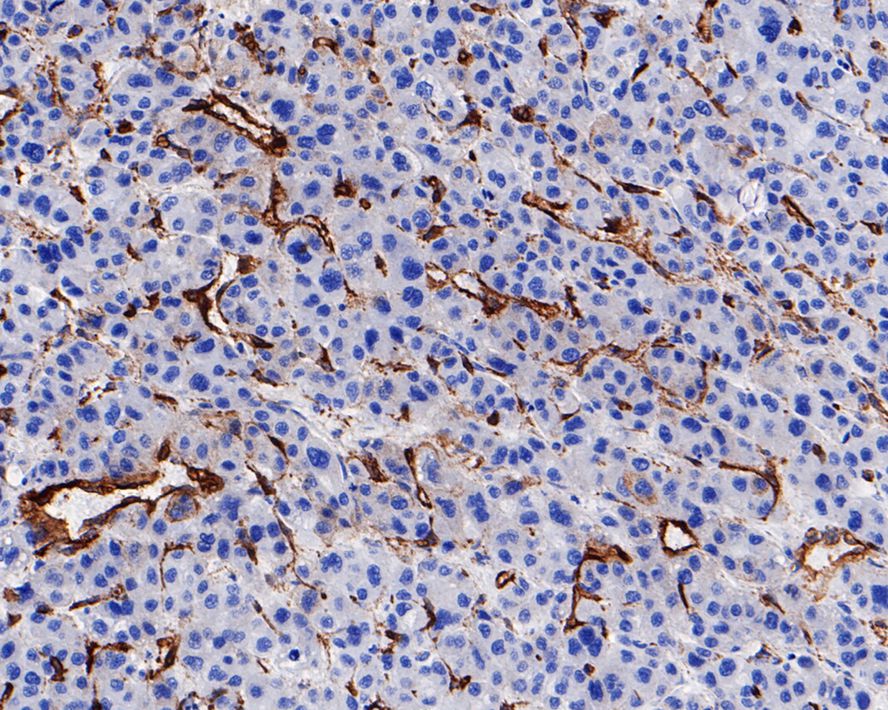 Immunohistochemical analysis of paraffin-embedded human uterus tissue with Rabbit anti-Caveolin-1 antibody (ET1603-1) at 1/200 dilution.<br />
<br />
The section was pre-treated using heat mediated antigen retrieval with Tris-EDTA buffer (pH 9.0) for 20 minutes. The tissues were blocked in 1% BSA for 20 minutes at room temperature, washed with ddH2O and PBS, and then probed with the primary antibody (ET1603-1) at 1/200 dilution for 1 hour at room temperature. The detection was performed using an HRP conjugated compact polymer system. DAB was used as the chromogen. Tissues were counterstained with hematoxylin and mounted with DPX.