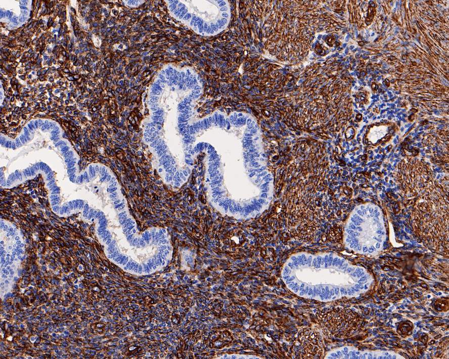 Immunohistochemical analysis of paraffin-embedded mouse lung tissue using anti-Caveolin-1 antibody. The section was pre-treated using heat mediated antigen retrieval with Tris-EDTA buffer (pH 8.0-8.4) for 20 minutes.The tissues were blocked in 5% BSA for 30 minutes at room temperature, washed with ddH2O and PBS, and then probed with the primary antibody (ET1603-1, 1/50) for 30 minutes at room temperature. The detection was performed using an HRP conjugated compact polymer system. DAB was used as the chromogen. Tissues were counterstained with hematoxylin and mounted with DPX.