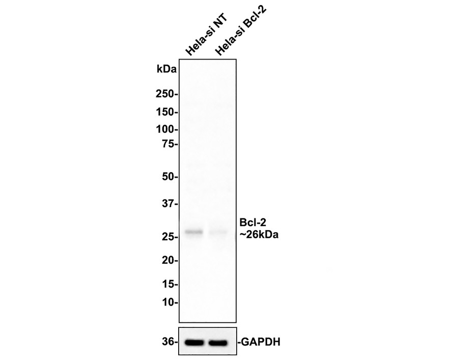 Western blot analysis of Bcl-2 on different lysates with Rabbit anti-Bcl-2 antibody (ET1603-11) at 1/1,000 dilution.<br />
<br />
Lane 1: Hela-si NT cell lysate<br />
Lane 2: Hela-si Bcl-2 cell lysate<br />
<br />
Lysates/proteins at 10 µg/Lane.<br />
<br />
Predicted band size: 26 kDa<br />
Observed band size: 26 kDa<br />
<br />
Exposure time: 31 seconds; ECL: merk<br />
<br />
4-20% SDS-PAGE gel.<br />
<br />
ET1603-11 was shown to specifically react with Bcl-2 in Hela-si NT cells. Weakened band was observed when Hela-si Bcl-2 sample was tested. Hela-si NT and Hela-si Bcl-2 samples were subjected to SDS-PAGE. Proteins were transferred to a PVDF membrane and blocked with 5% NFDM in TBST for 1 hour at room temperature. The primary antibody (ET1603-11, 1/1,000) and Loading control antibody (Rabbit anti-GAPDH, ET1601-4, 1/10,000) were used in 5% BSA at room temperature for 2 hours. Goat Anti-rabbit IgG-HRP Secondary Antibody (HA1001) at 1:100,000 dilution was used for 1 hour at room temperature.