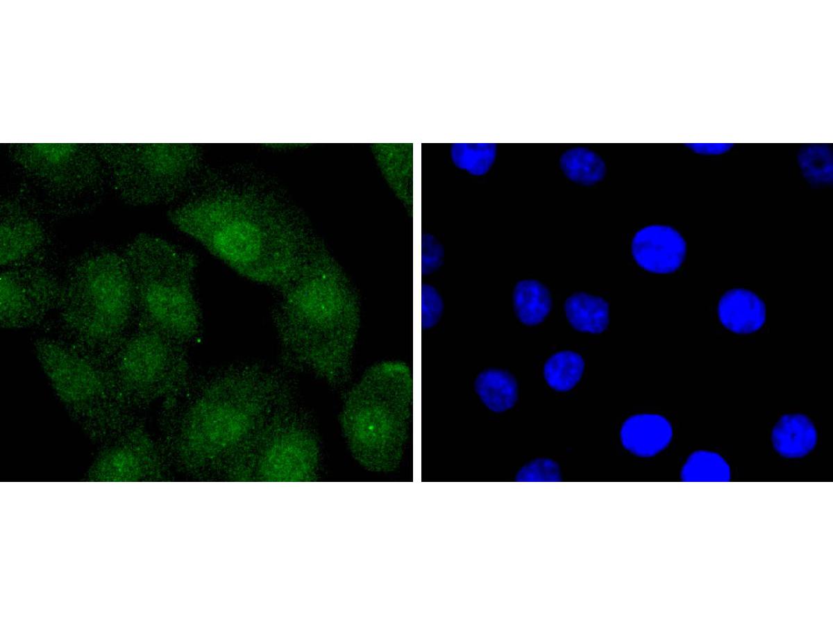 ICC staining of Bcl-2 in A549 cells (green). Formalin fixed cells were permeabilized with 0.1% Triton X-100 in TBS for 10 minutes at room temperature and blocked with 1% Blocker BSA for 15 minutes at room temperature. Cells were probed with the primary antibody (ET1603-11, 1/50) for 1 hour at room temperature, washed with PBS. Alexa Fluor®488 Goat anti-Rabbit IgG was used as the secondary antibody at 1/1,000 dilution. The nuclear counter stain is DAPI (blue).