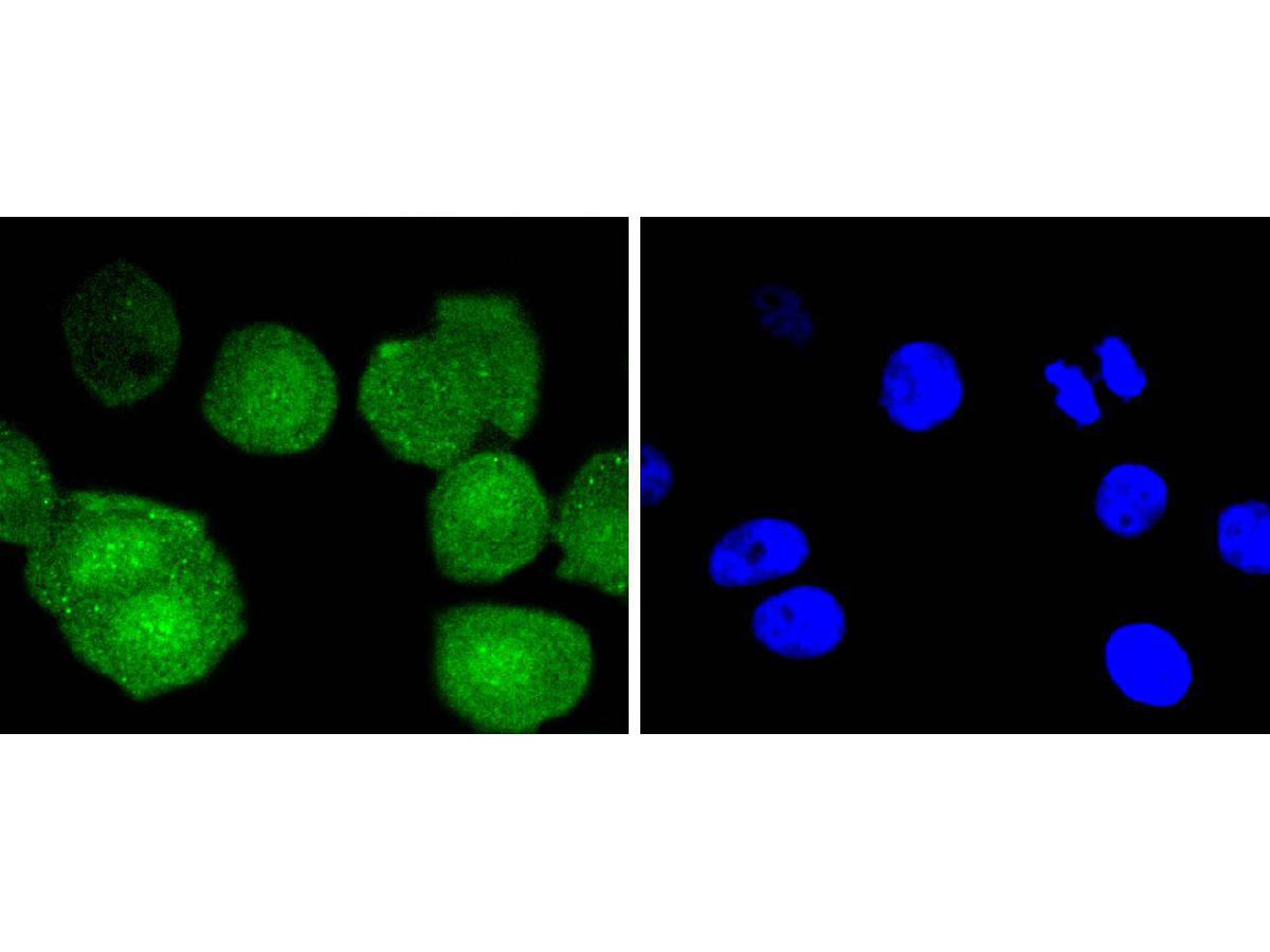 ICC staining of Bcl-2 in SH-SY5Y cells (green). Formalin fixed cells were permeabilized with 0.1% Triton X-100 in TBS for 10 minutes at room temperature and blocked with 1% Blocker BSA for 15 minutes at room temperature. Cells were probed with the primary antibody (ET1603-11, 1/50) for 1 hour at room temperature, washed with PBS. Alexa Fluor®488 Goat anti-Rabbit IgG was used as the secondary antibody at 1/1,000 dilution. The nuclear counter stain is DAPI (blue).