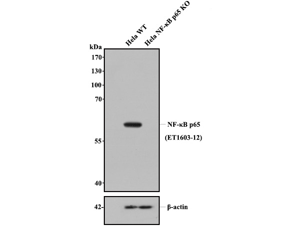 All lanes: Western blot analysis of NF-κB p65 with anti-NF-κB p65 antibody [SZ10-04] (ET1603-12) at 1:500 dilution.<br />
Lane 1: Wild-type Hela whole cell lysate (20 µg).<br />
Lane 2: NF-κB p65 knockout Hela whole cell lysate (20 µg).<br />
<br />
ET1603-12 was shown to specifically react with NF-κB p65 in wild-type Hela cells. No band was observed when NF-κB p65 knockout sample was tested. Wild-type and NF-κB p65 knockout samples were subjected to SDS-PAGE. Proteins were transferred to a PVDF membrane and blocked with 5% NFDM in TBST for 1 hour at room temperature. The primary antibody (ET1603-12, 1/500) and Loading control antibody (Rabbit anti-β-actin, R1207-1, 1/1,000) was used in 5% BSA at room temperature for 2 hours. Goat Anti-Rabbit IgG-HRP Secondary Antibody (HA1001) at 1:200,000 dilution was used for 1 hour at room temperature.