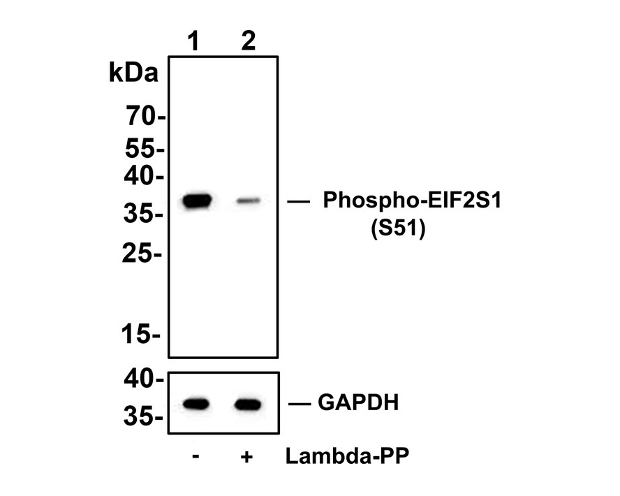 Western blot analysis of Phospho-EIF2S1 (S51) on THP-1 cell lysates.<br />
<br />
Lane 1: THP-1 cells, whole cell lysate, 10ug/lane<br />
Lane 2: THP-1 cells treated with 2.8ug/ul lambda-PP for 30 minutes, whole cell lysates, 10ug/lane<br />
<br />
All lanes :<br />
Anti-Phospho-EIF2S1 (S51) antibody (ET1603-14) at 1/500 dilution. Anti-GAPDH antibody (ET1601-4) at 1/10,000 dilution. Goat Anti-Rabbit IgG H&L (HRP) (HA1001) at 1/200,000 dilution.<br />
<br />
Predicted band size: 36 kDa<br />
Observed band size: 36 kDa<br />
<br />
Blocking and diluting buffer: 5% BSA.<br />
<br />
Exposure time: 3 minutes 43 seconds