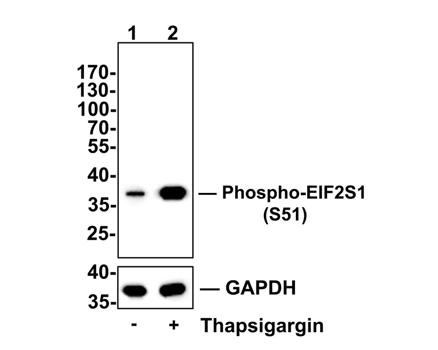 Western blot analysis of Phospho-EIF2S1 (S51) on C2C12 cell lysates.<br />
<br />
Lane 1: C2C12 cells, whole cell lysate, 10ug/lane<br />
Lane 1: C2C12 cells treated with 300nM thapsigargin for 30 minutes, whole cell lysates, 10ug/lane<br />
<br />
All lanes :<br />
Anti-Phospho-EIF2S1 (S51) antibody (ET1603-14<br />
) at 1:500 dilution. Anti-GAPDH antibody (ET1601-4) at 1:10,000 dilution. Goat Anti-Rabbit IgG H&L (HRP) (HA1001) at 1/200,000 dilution.<br />
<br />
Predicted band size: 36 kDa<br />
Observed band size: 36 kDa<br />
<br />
Blocking and diluting buffer: 5% BSA.<br />
<br />
Exposure time: 3 minutes 43 seconds