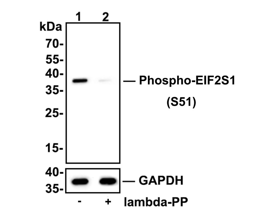 Western blot analysis of Phospho-EIF2S1 (S51) on mouse spleen tissue lysates.<br />
<br />
Lane 1: mouse spleen tissue, whole tissue lysate, 20ug/lane<br />
Lane 1: mouse spleen tissue treated with 2.8ug/ul lambda-PP for 30 minutes, whole tissue lysates, 20ug/lane<br />
<br />
All lanes :<br />
Anti-Phospho-EIF2S1 (S51) antibody (ET1603-14) at 1/500 dilution. Anti-GAPDH antibody (ET1601-4) at 1/10,000 dilution. Goat Anti-Rabbit IgG H&L (HRP) (HA1001) at 1/200,000 dilution.<br />
<br />
Predicted band size: 36 kDa<br />
Observed band size: 36 kDa<br />
<br />
Blocking and diluting buffer: 5% BSA.<br />
<br />
Exposure time: 3 minutes 43 seconds