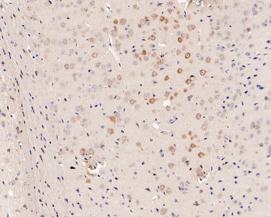 Immunohistochemical analysis of paraffin-embedded mouse brain tissue with Rabbit anti-Phospho-EIF2S1 (S51) antibody (ET1603-14) at 1/200 dilution.<br />
<br />
The section was pre-treated using heat mediated antigen retrieval with Tris-EDTA buffer (pH 9.0) for 20 minutes. The tissues were blocked in 1% BSA for 20 minutes at room temperature, washed with ddH2O and PBS, and then probed with the primary antibody (ET1603-14) at 1/200 dilution for 1 hour at room temperature. The detection was performed using an HRP conjugated compact polymer system. DAB was used as the chromogen. Tissues were counterstained with hematoxylin and mounted with DPX.