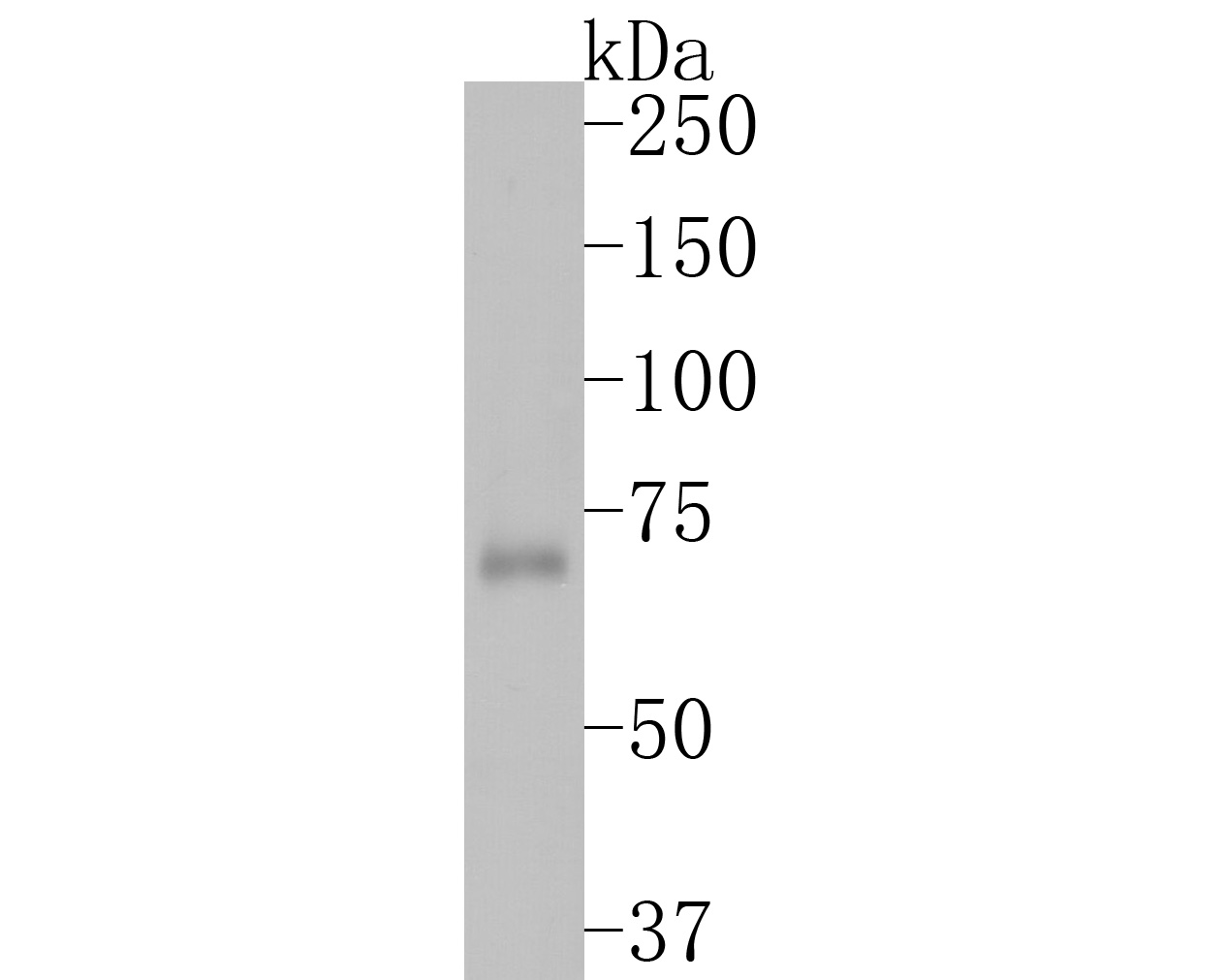 Western blot analysis of ATF2 on THP-1 cell lysates. Proteins were transferred to a PVDF membrane and blocked with 5% BSA in PBS for 1 hour at room temperature. The primary antibody (ET1603-15, 1/500) was used in 5% BSA at room temperature for 2 hours. Goat Anti-Rabbit IgG - HRP Secondary Antibody (HA1001) at 1:200,000 dilution was used for 1 hour at room temperature.