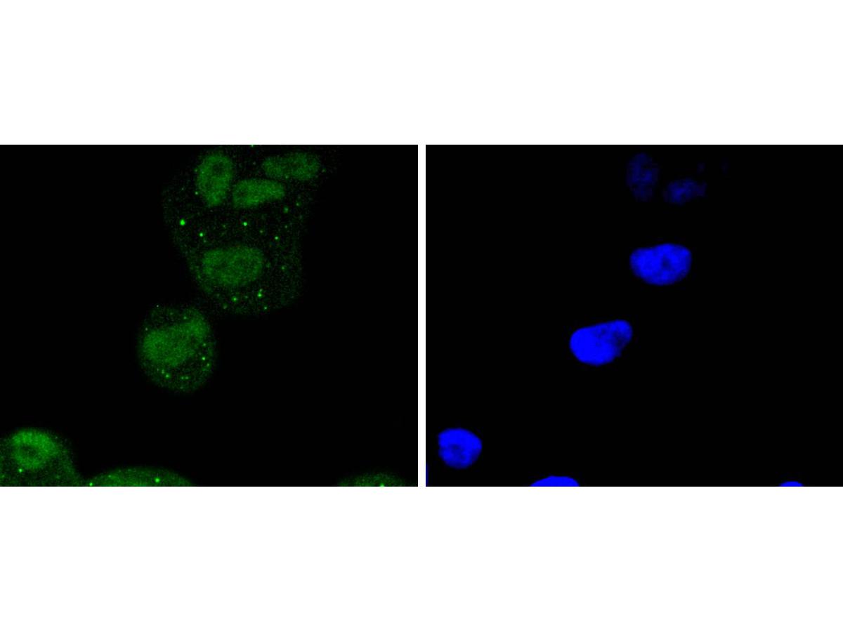 ICC staining of ATF2 in Hela cells (green). Formalin fixed cells were permeabilized with 0.1% Triton X-100 in TBS for 10 minutes at room temperature and blocked with 10% negative goat serum for 15 minutes at room temperature. Cells were probed with the primary antibody (ET1603-15, 1/50) for 1 hour at room temperature, washed with PBS. Alexa Fluor®488 conjugate-Goat anti-Rabbit IgG was used as the secondary antibody at 1/1,000 dilution. The nuclear counter stain is DAPI (blue).
