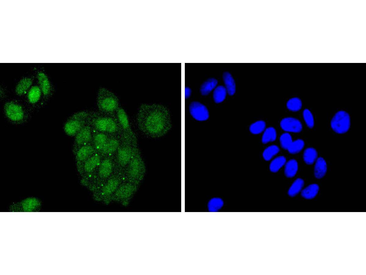 ICC staining of ATF2 in MCF-7 cells (green). Formalin fixed cells were permeabilized with 0.1% Triton X-100 in TBS for 10 minutes at room temperature and blocked with 10% negative goat serum for 15 minutes at room temperature. Cells were probed with the primary antibody (ET1603-15, 1/50) for 1 hour at room temperature, washed with PBS. Alexa Fluor®488 conjugate-Goat anti-Rabbit IgG was used as the secondary antibody at 1/1,000 dilution. The nuclear counter stain is DAPI (blue).