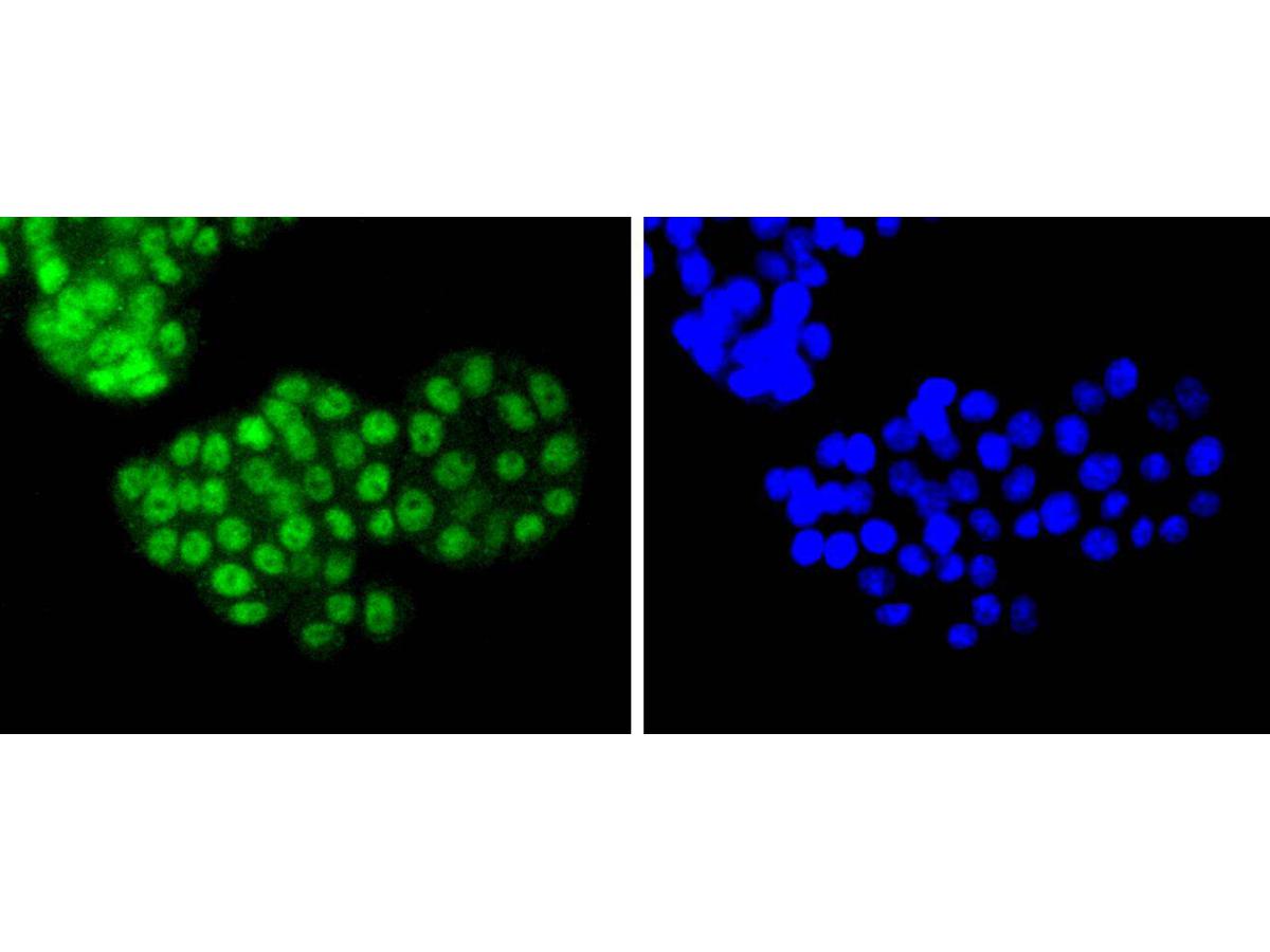 ICC staining of ATF2 in PC-12 cells (green). Formalin fixed cells were permeabilized with 0.1% Triton X-100 in TBS for 10 minutes at room temperature and blocked with 10% negative goat serum for 15 minutes at room temperature. Cells were probed with the primary antibody (ET1603-15, 1/50) for 1 hour at room temperature, washed with PBS. Alexa Fluor®488 conjugate-Goat anti-Rabbit IgG was used as the secondary antibody at 1/1,000 dilution. The nuclear counter stain is DAPI (blue).